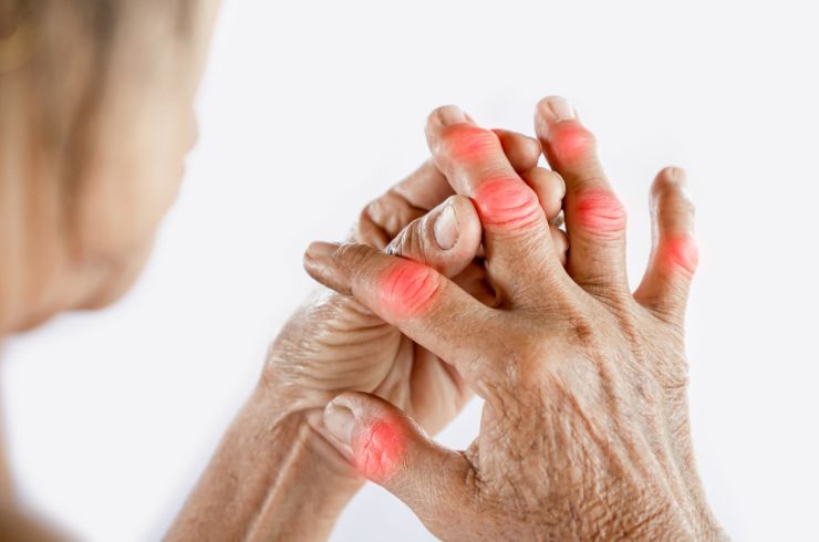 Rheumatology