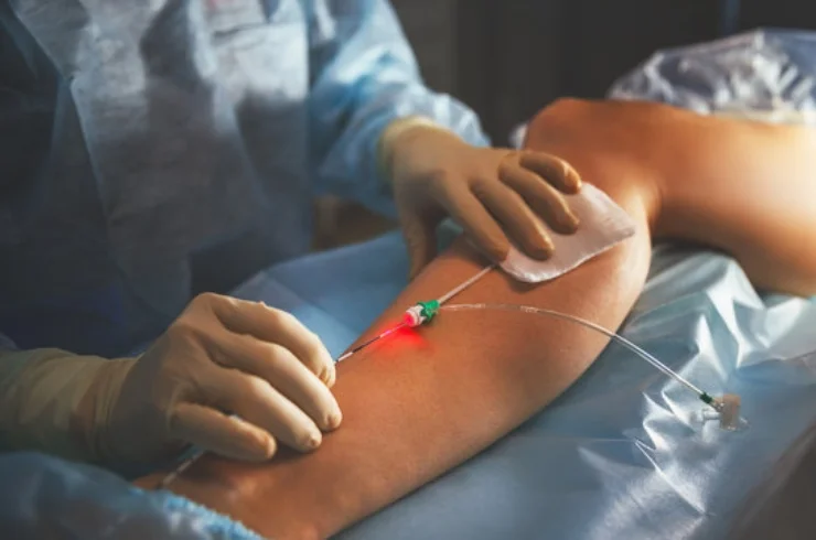 Vascular Surgery2